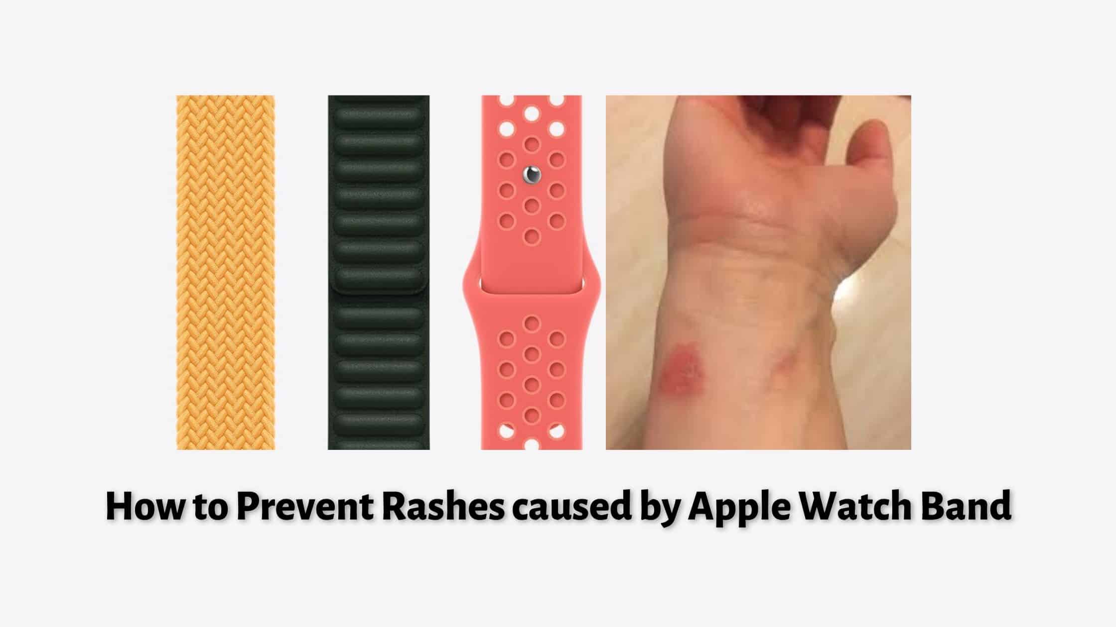 How to Prevent Rashes caused by Apple Watch Band|Symbol for nickel